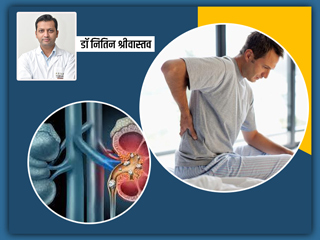 गुर्दे की पथरी (किडनी स्टोन) से बचाव के 10 उपाय, जानें एक्सपर्ट डॉक्टर से