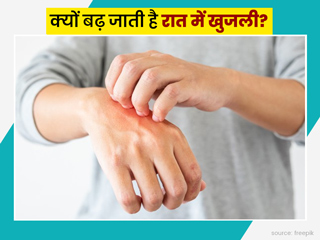  सोते समय आपके शरीर में भी बढ़ जाती है खुजली? जानें इसके 7 कारण और दूर करने के उपाय