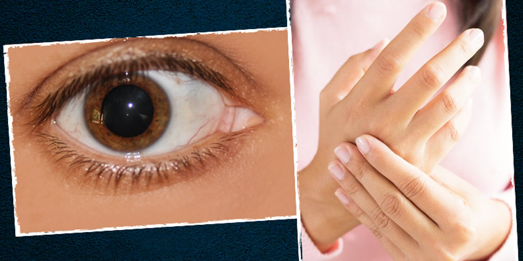 Effects Of Arthritis On Eyes Know From Expert आंखों को कैसे प्रभावित करता है अर्थराइटिस? जानें