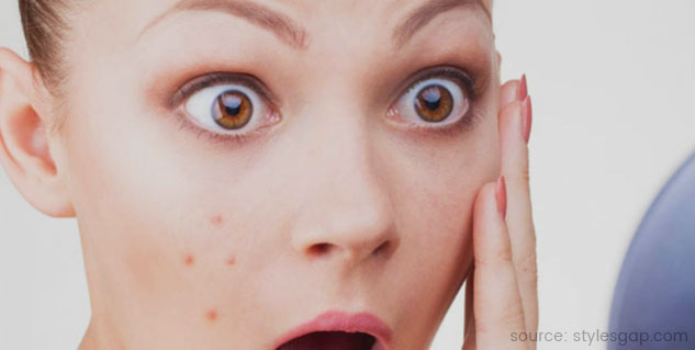Garlic Peels Remove Pimples