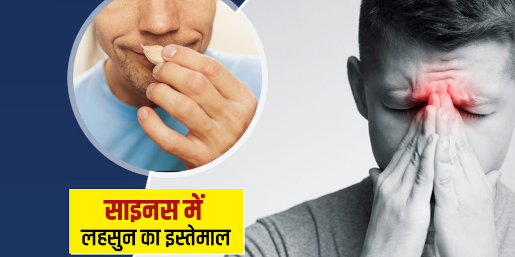 Garlic in nose to get relief from sinus in hindi क्या नाक के अंदर