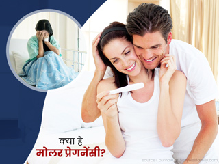 क्या है माेलर प्रेगनेंसी? जानें इसके लक्षण, कारण और उपचार