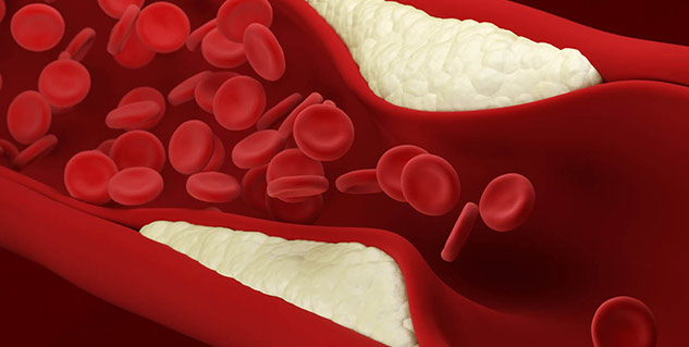 What Are Triglycerides Causes Symptoms And Treatment In Hindi क य ह त ह ट र इग ल सर इड स इसक लक षण क रण और उप य