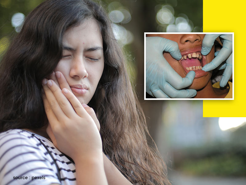What Causes Gum Holes? Know The Treatment Methods Available For Curing This Condition