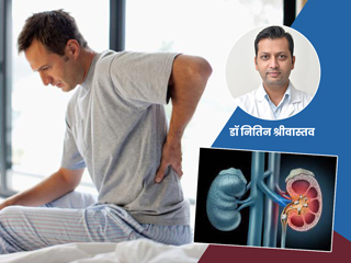 एक्सपर्ट से जानें किडनी स्टोन से जुड़ी 9 भ्रामक बातें (मिथक) और उनकी सच्चाई