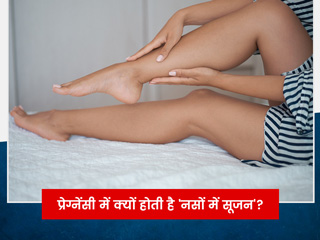 प्रेग्नेंसी में क्यों होती है नसों में सूजन की समस्या? जानें इसके कारण और इलाज