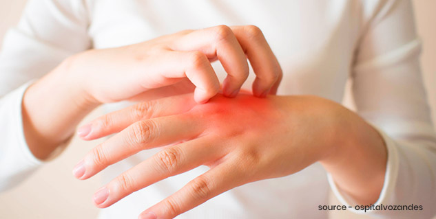 skin allergy