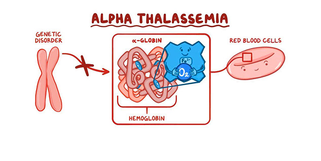 alpha thalassemia