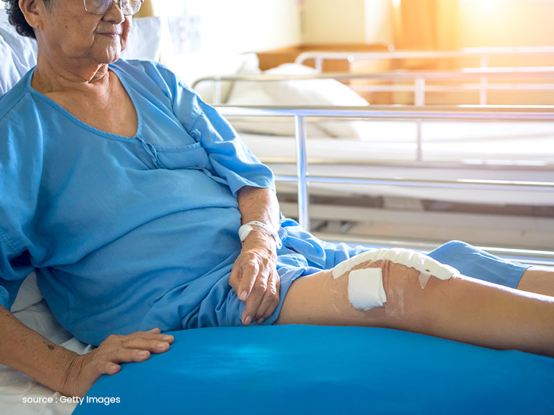 Tips For Rehabilitation After Joint Replacement Surgery