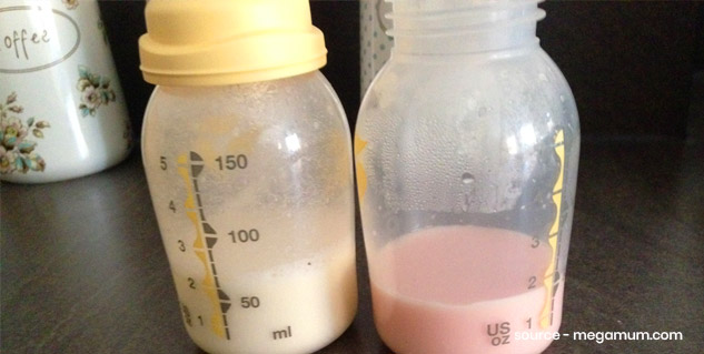 bleeding from breast