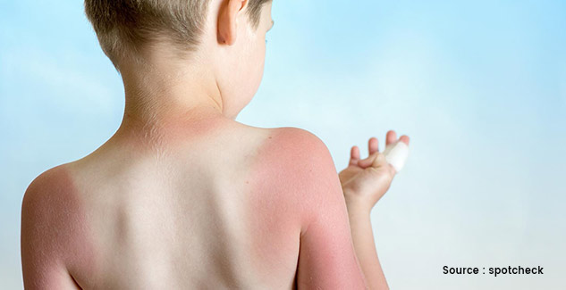 skin cancer in kids