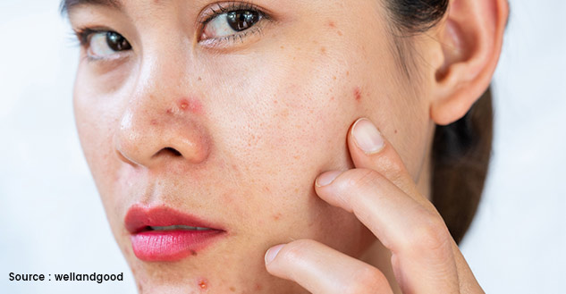 patch test for skin