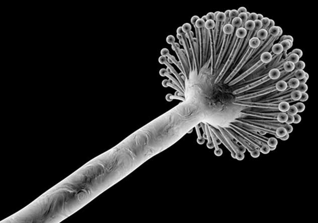 inside5_aspergillosis