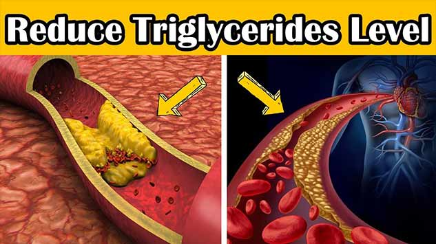 Effect Of Triglycerides On Overall Health And Risk Factors OnlyMyHealth   Inside Blood3 