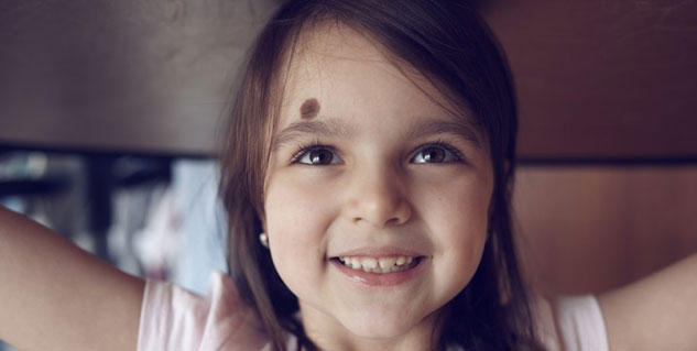 Inside_birthmark (1)