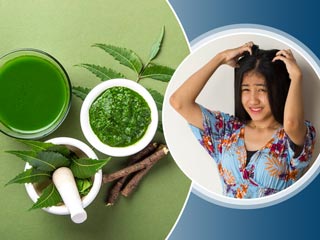 सिर (स्कैल्प) पर हो फंगल इंफेक्शन तो आजमाएं ये 5 घरेलू नुस्खे