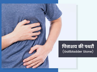 पित्ताशय की पथरी (Gallbladder Stone) के 8 कारण, लक्षण और बचाव
