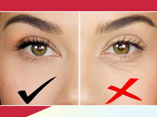 आंखों के नीचे झुर्रियों से छुटकारा दिलाए ये 6 आसान से नुस्खे