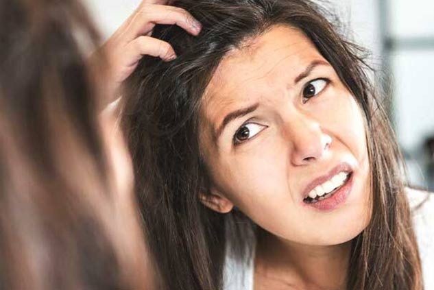 dandruff