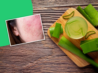 चेहरे से लालपन (Redness) दूर करने के घरेलू उपाय