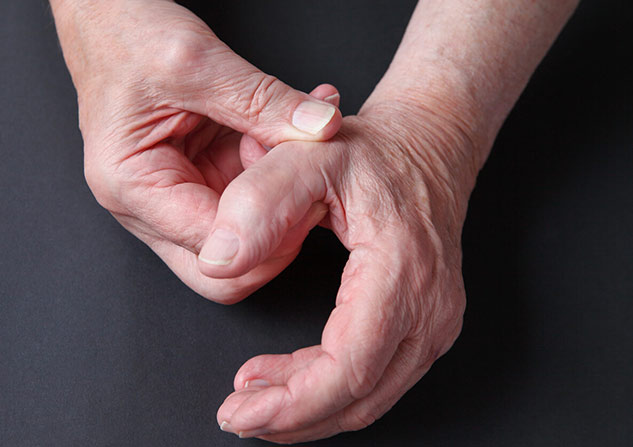 thumb arthritis causes