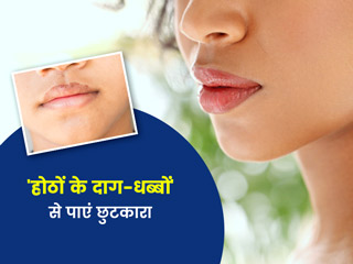 होंठों के दाग-धब्बों से छुटकारा दिलाएंगे ये 7 घरेलू उपाय