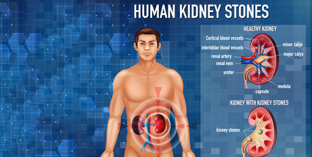 over active bladder 