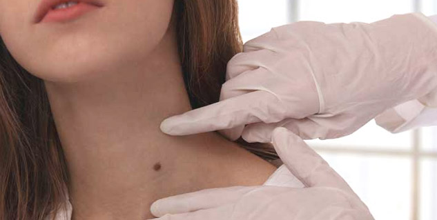 benign-tumor-symptoms