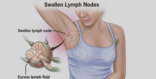 armpit lump causes