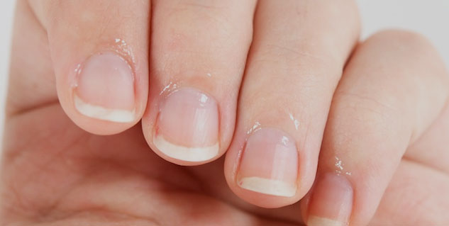 damaged cuticles