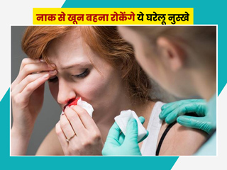 नाक से खून आने की समस्या दूर करेंगे ये 8 घरेलू नुस्खे 