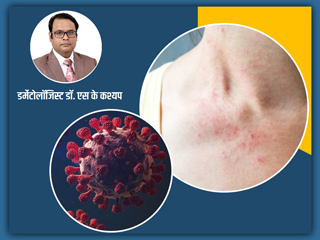 वैक्सीन लेने के बाद कुछ लोगों में दिख रही हैं ये स्किन समस्याएं, डॉक्टर से जानें इनका कारण और बचाव के टिप्स