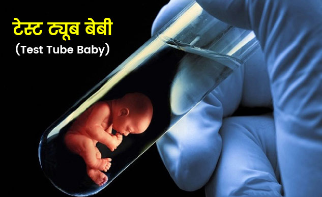 IVF or Test Tube Baby