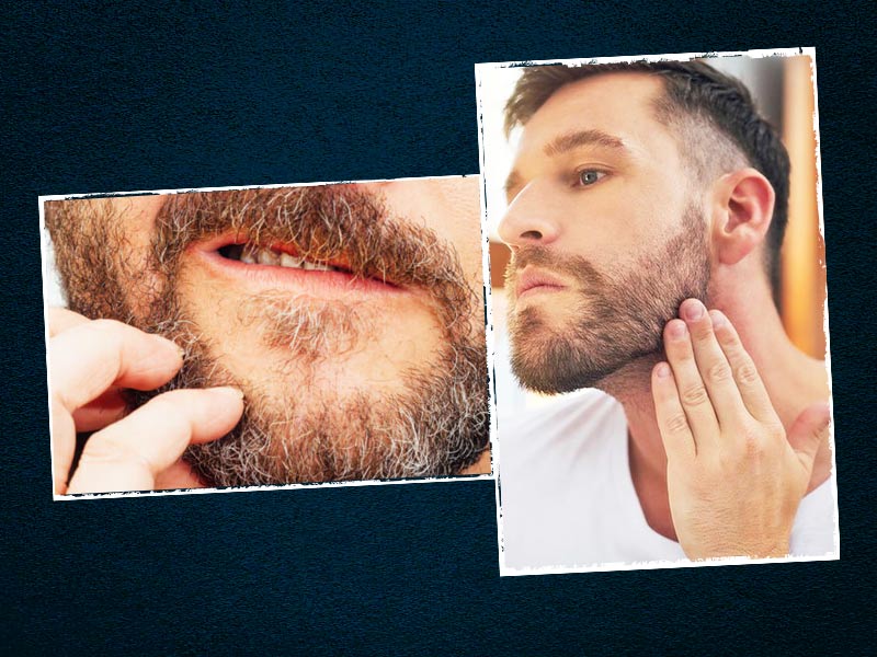दाढ़ी में डैंड्रफ, खुजली, रूखापान दूर करने और तेजी से दाढ़ी बढ़ाने के लिए अपनाएं ये 5 घरेलू उपाय