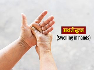 हाथ में सूजन क्यों होती है? जानें इसके कारण, लक्षण, इलाज और बचाव के उपाय