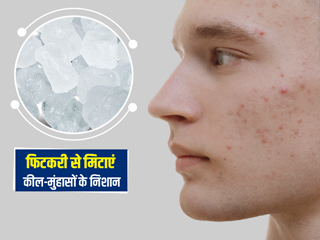 चेहरे पर कील मुहांसों के निशान और दाग-धब्बे दूर करेगी फिटकरी, इन 3 तरीकों से करें प्रयोग