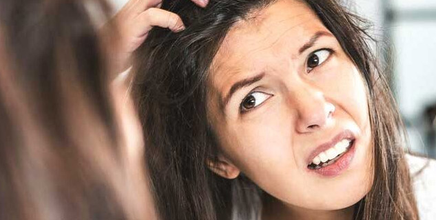 dandruff