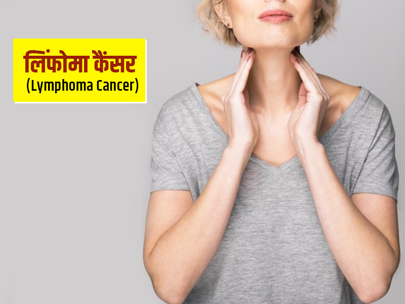 क्या है लिंफोमा कैंसर के 13 लक्षण? जानें इसके प्रकार, अवस्था और इलाज