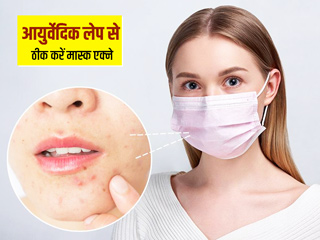 गर्मी में मास्क पहनने से चेहरे पर आ गए दाने और रैशेज? इन 5 आयुर्वेदिक लेप से दूर करें ये समस्या 