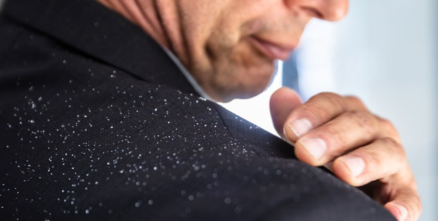 dandruff