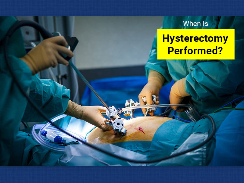 When Is Hysterectomy or Uterus Removal Surgery Performed?