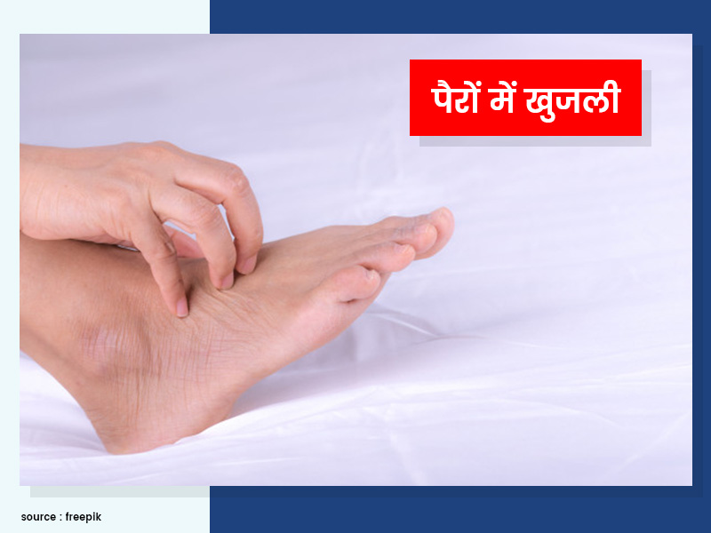 पैरों की खुजली को दूर करने के लिए आजमाएं ये 5 घरेलू उपाय