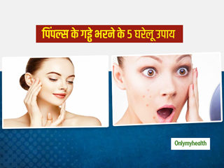 पिंपल्स के कारण त्वचा पर दिखने लगे हैं गड्ढे या छेद? इन 5 घरेलू उपायों से पाएं इस समस्या से छुटकारा