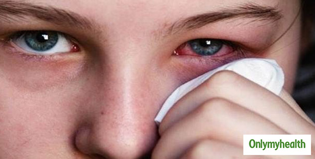 red eyes causes 