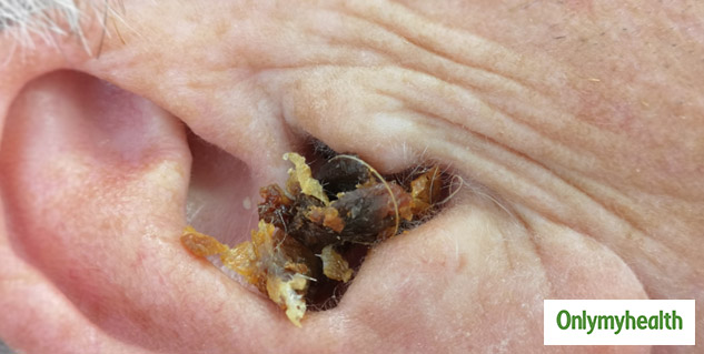 side effects of oil in ear