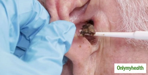 putting oil in ear benefits