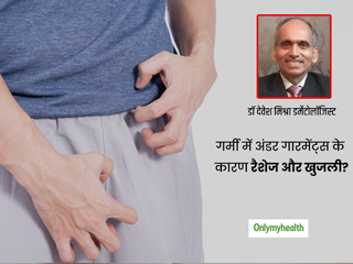 गर्मी में अंडर गारमेंट्स के कारण होती है रैशेज़ और खुजली की समस्या, तो ये हैं बचाव के लिए कुछ जरूरी टिप्‍स