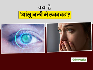 Blocked Tear Duct: क्या है 'आंसू नली में रूकावट'? जानें लक्षण, कारण और उपचार