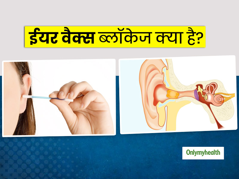 कान की ठीक से सफाई न करने से हो सकती है 'ईयर वैक्स ब्लॉकेज' की समस्या, जानें इसके लक्षण, कारण और बचाव