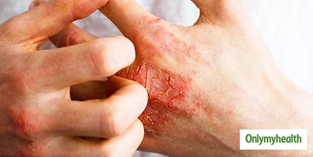 inside1_soapallergy